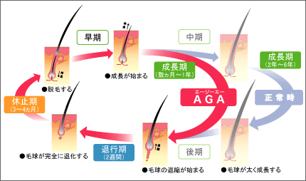 AGA_ヘアサイクルの画像