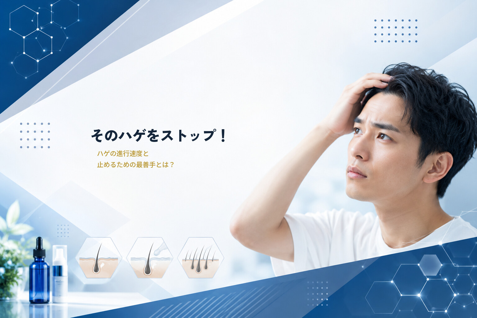 そのハゲをストップ！ハゲの進行速度と止めるための最善手とは？