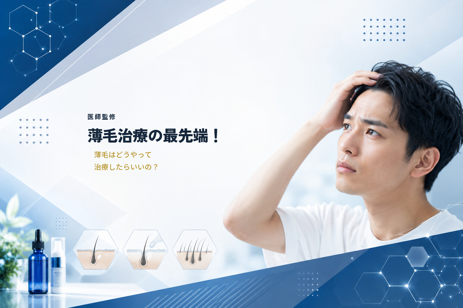 【医師監修】薄毛治療の最先端！薄毛はどうやって治療したらいいの？