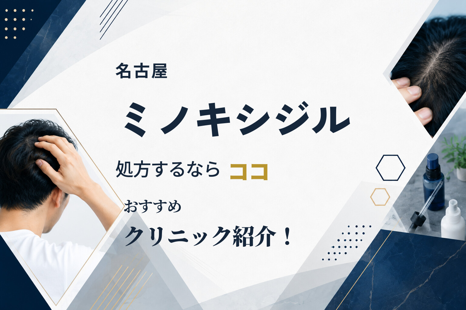 名古屋でミノキシジルを処方するならココ｜おすすめクリニック紹介！
